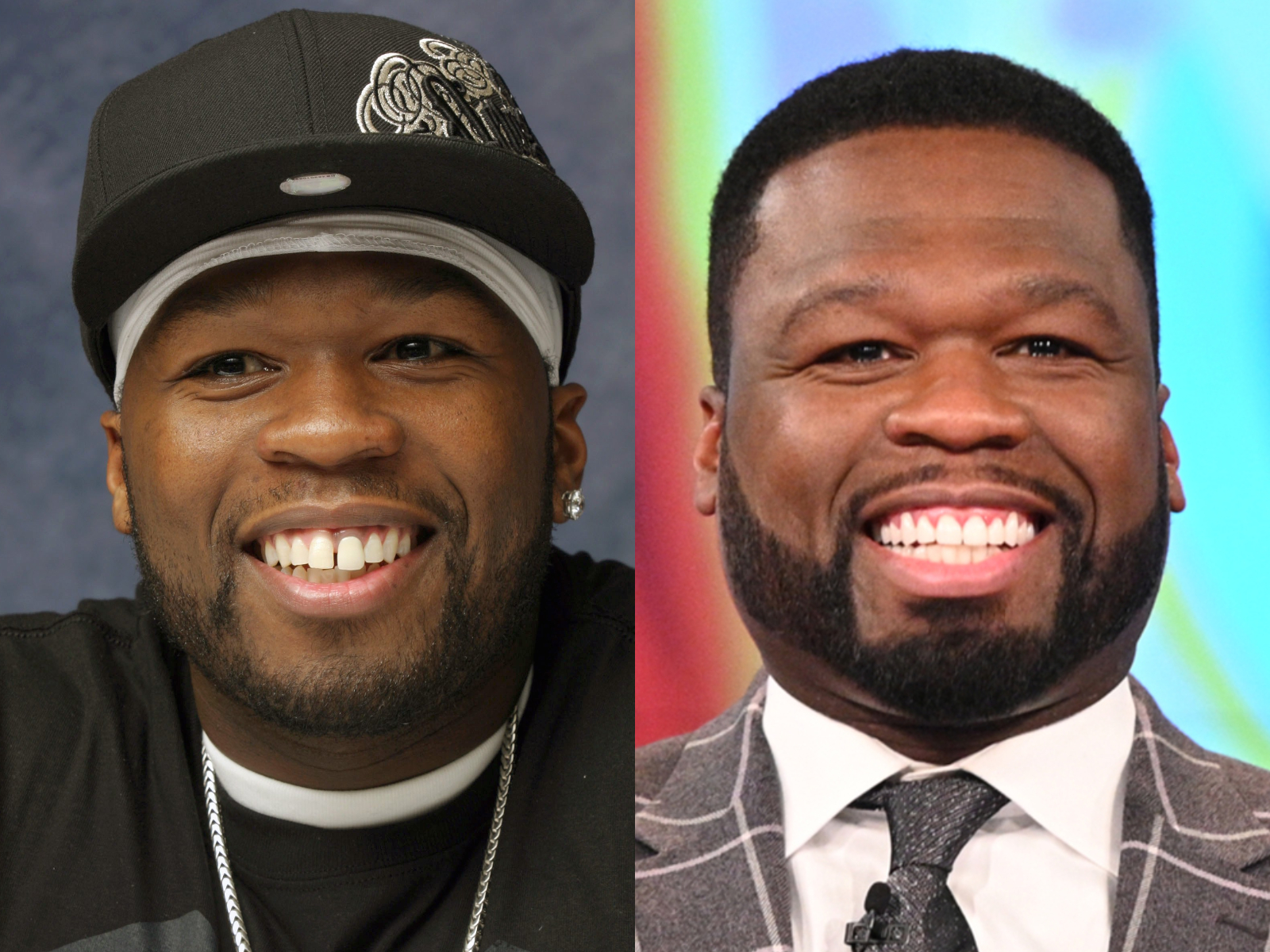 Top 20 de celebridades con mala dentadura 50 Cent