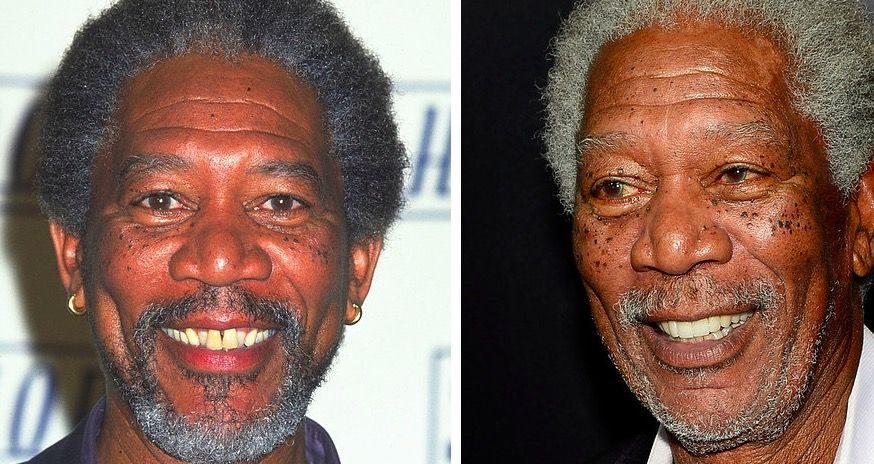 Top 20 de celebridades con mala dentadura Morgan Freeman