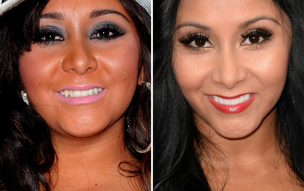 Top 20 de celebridades con mala dentadura Snooki