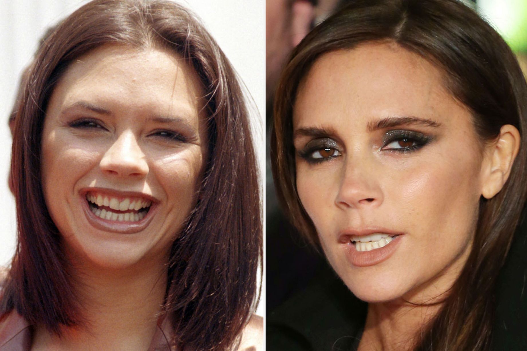 Top 20 de celebridades con mala dentadura Victoria Beckham