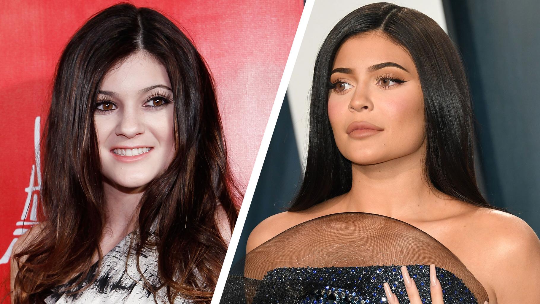 Kylie Jenner Celebridades y sus cirugías plásticas