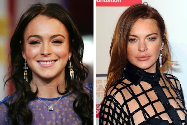 Lindsay Lohan Celebridades y sus cirugías plásticas