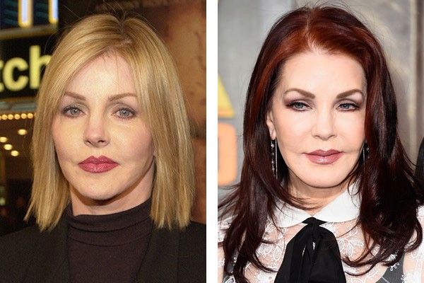 Priscilla Presley Celebridades y sus cirugías plásticas